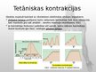 Presentations 'Muskuļu fizioloģija', 30.