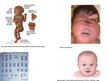 Presentations 'Ģenētikas pētīšanas metodes - amniocentēze', 11.