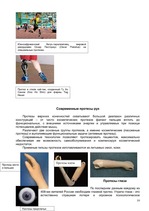 Research Papers 'Искусственные органы человеческого тела и современные протезы', 10.