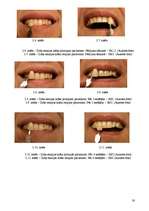 Research Papers 'Dabīgo un mākslīgo krāsvielu ietekme uz zoba emalju', 29.