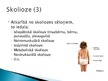 Presentations 'Korsete - palīglīdzeklis idioptiskās skoliozes ārstēšanai pusaudžu vecumā', 7.