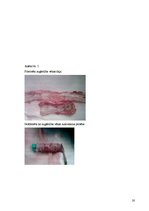 Research Papers 'Pēc A.femoralis aneirismas protezēšanas iegūtās infekcijas pacientiem', 20.
