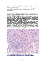 Research Papers 'Bezpigmenta melanoma', 13.
