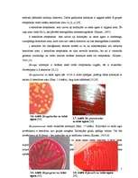 Research Papers 'Ģints "streptococcus" mikroorganismu izolēšana no patoloģiskā materiāla un ident', 7.