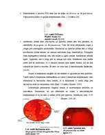 Research Papers 'Ģints "streptococcus" mikroorganismu izolēšana no patoloģiskā materiāla un ident', 12.