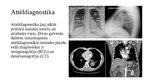 Presentations 'Plauša vēža jaunākas diagnostikas un ārstēšanas metodes', 4.