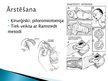 Presentations 'Pylorus stenoze', 20.