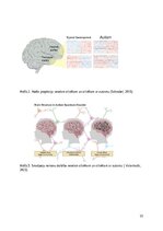 Research Papers 'Autiskā spektra traucējumi', 15.
