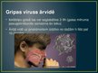 Presentations 'Vīrusu infekcijas', 8.