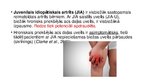 Presentations 'Ar juvenilu idiopātisku artrītu saistīts uveīts', 5.