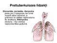 Presentations 'Antibiotiku izvēle grūtniecības laikā', 13.