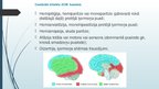 Presentations 'Išēmisks insults', 8.