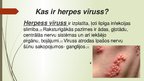 Presentations 'Herpes vīruss', 2.
