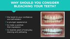 Presentations 'Professional Teeth Bleaching', 2.