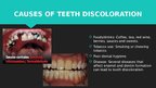 Presentations 'Professional Teeth Bleaching', 4.