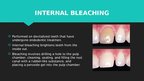 Presentations 'Professional Teeth Bleaching', 9.