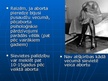 Presentations 'Pēcaborta sindroms', 5.