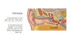 Presentations 'Cochlear Implant', 5.