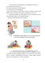 Research Papers 'Vecāku rīcība traumu gadījumā mazbērniem sadzīves apstākļos', 20.