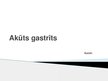 Presentations 'Akūts gastrīts', 1.