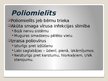 Presentations 'Poliomielīts', 3.