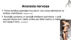 Presentations 'Anorexia nervosa (anoreksija), bulimia nervosa (bulīmija), kompulsīvā pārēšanās', 50.