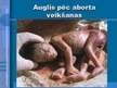 Presentations 'Aborta definīcija un abortu veidi', 4.