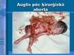 Presentations 'Aborta definīcija un abortu veidi', 6.