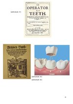 Research Papers 'Zobu protezēšana', 31.