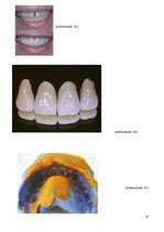 Research Papers 'Zobu protezēšana', 33.