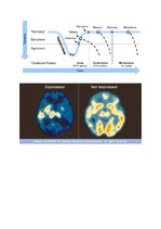 Research Papers 'Depresijas ietekme uz organismu un smadzenēm', 10.