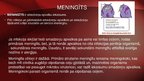 Presentations 'Neisseria meningitidis - meningokoki', 16.