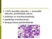 Presentations 'Hroniskas mieloleikozes raksturojums un laboratoriskā diagnostika', 10.