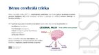 Presentations 'Elektrostimulācijas terapija bērniem ar cerebrālo trieku', 3.