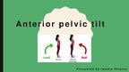 Presentations 'Anterior Pelvic Tilt', 1.