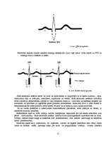 Research Papers 'Sirds vadīšanas sistēma un ritma traucējumi', 22.