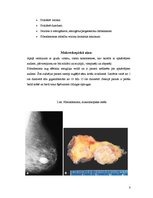 Summaries, Notes 'Fibroadenoma. Fibrocistiska krūts slimība', 8.