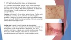 Presentations 'Herpes vīrusa mikrobioloģiskais raksturojums, vīrusa infekcijas izpausemes uz ād', 5.