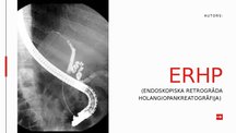 Presentations 'Endoskopiska retrogrāda holangiopankreatogrāfija', 1.