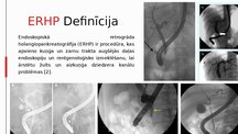 Presentations 'Endoskopiska retrogrāda holangiopankreatogrāfija', 4.