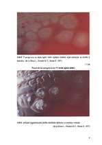 Research Papers 'Pseudomoana aeruginosa mikroorganismu izolēšana no patoloģiskā materiāla un iden', 9.