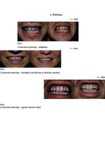 Research Papers 'Zobu higiēna un tās ietekme uz zobu veselību', 36.