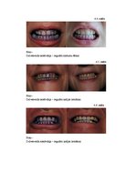 Research Papers 'Zobu higiēna un tās ietekme uz zobu veselību', 37.