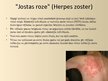 Presentations 'Herpes vīruss', 15.