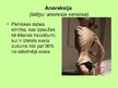 Presentations 'Sabiedrības zināšanas par bulīmiju un anoreksiju', 6.