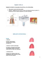 Summaries, Notes 'Izņemamās zobu protēzes balstītas, uz implantiem', 4.