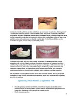 Summaries, Notes 'Izņemamās zobu protēzes balstītas, uz implantiem', 13.