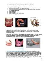 Summaries, Notes 'Izņemamās zobu protēzes balstītas, uz implantiem', 18.