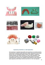 Summaries, Notes 'Izņemamās zobu protēzes balstītas, uz implantiem', 19.