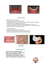 Summaries, Notes 'Izņemamās zobu protēzes balstītas, uz implantiem', 20.